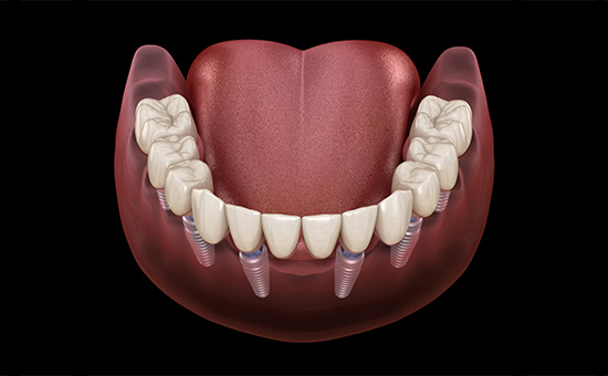 2024年马鞍山市种植牙牙科价格(收费标准)_2024全新公示
