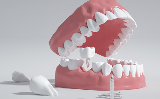 南京市牙齿矫正托槽医院排行榜前10人气机构公布（南京伯尼口腔专家大咖实力入围）