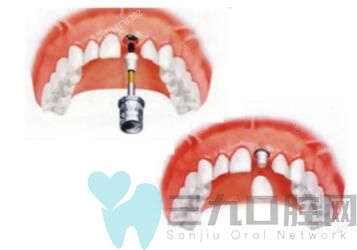 2025年合肥种植牙医院排名前十曝光，告诉你哪家种植牙靠谱口碑好